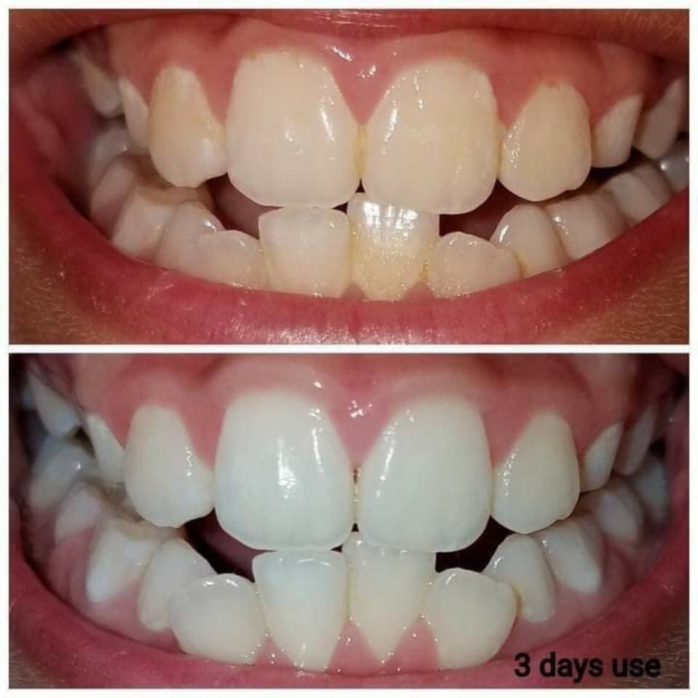Ap 24 whitening toothpaste